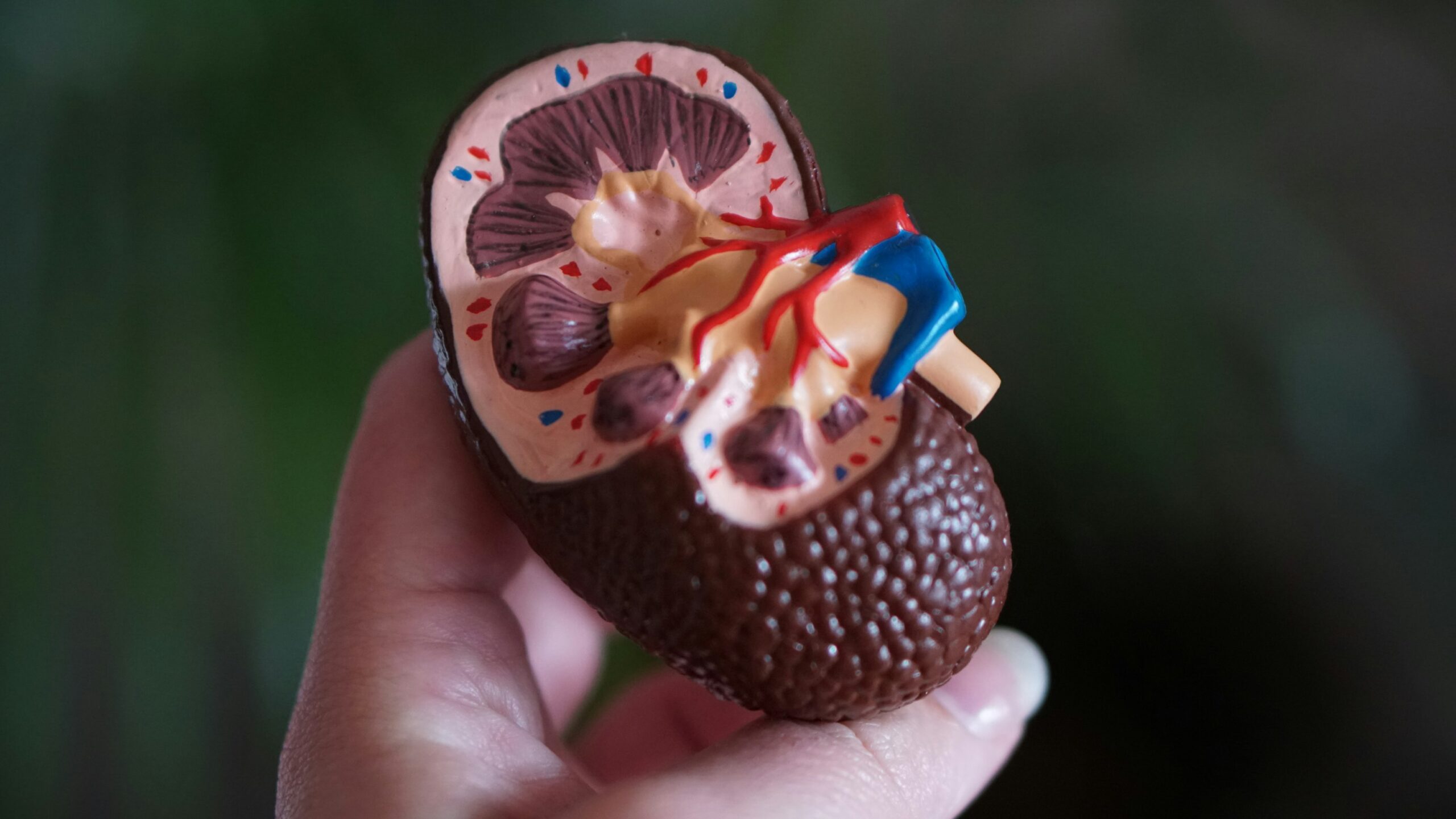UCLA scientists have engineered AlloCAR70-NKT—an “off-the-shelf” immune cell therapy, ready-to-use, that attacks kidney tumors directly, reprograms protective environments, and avoids need for custom patient cells. A hopeful leap for late-stage cancer treatment.