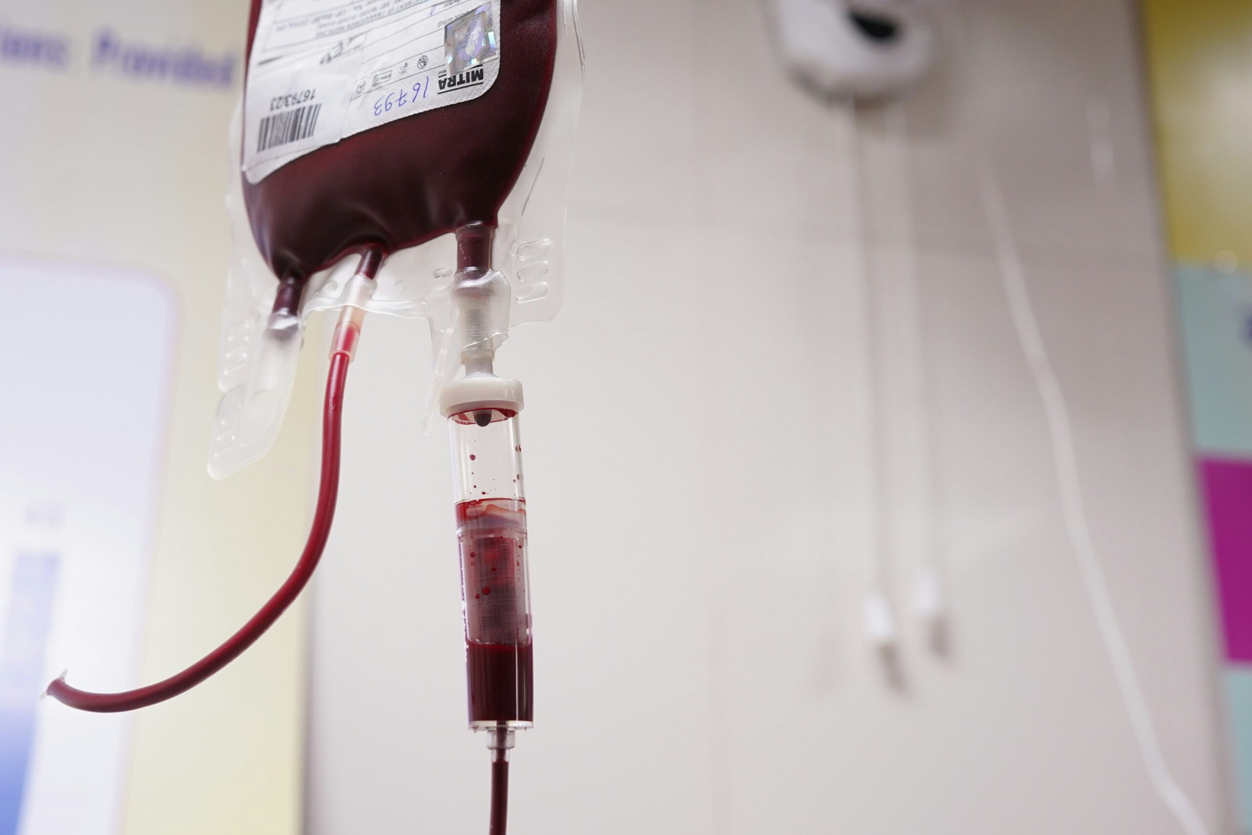 New research shows that bone marrow transplants from partially matched donors are now as safe and effective as those from full matches. This advance could offer life-saving treatment to more blood cancer patients who previously lacked a donor.